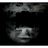 tfinn
